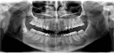 radiologia