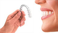 invisalign