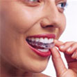 invisalign