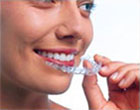 invisalign